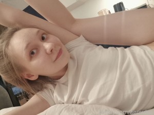 aemulus Photo #22