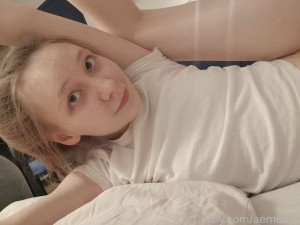 aemulus Photo #23